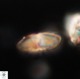 Discoaster lenticularis 65006