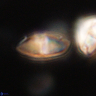 Discoaster lenticularis 65007