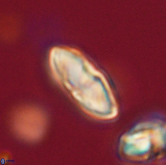 Discoaster lenticularis 65009