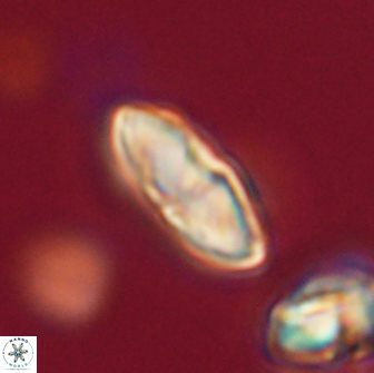 Discoaster lenticularis 65009