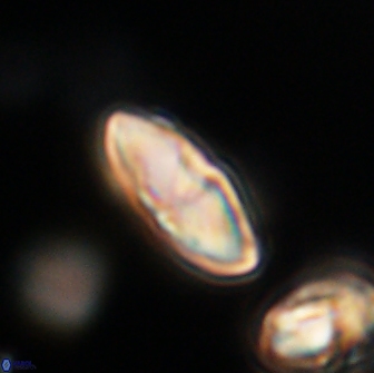 Discoaster lenticularis 65010