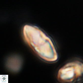 Discoaster lenticularis 65010