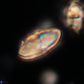 Discoaster lenticularis 65011
