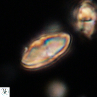Discoaster lenticularis 65011