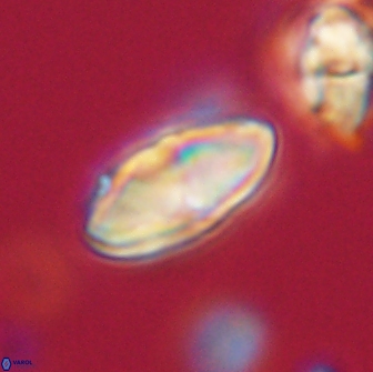 Discoaster lenticularis 65012