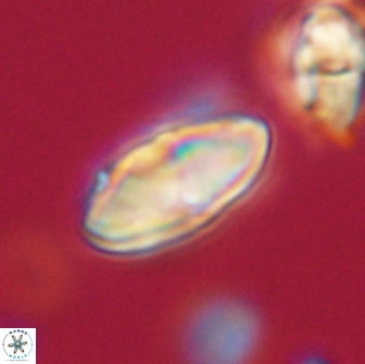 Discoaster lenticularis 65012