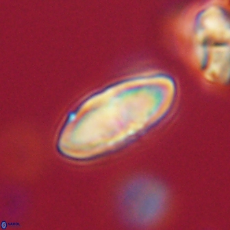 Discoaster lenticularis 65013