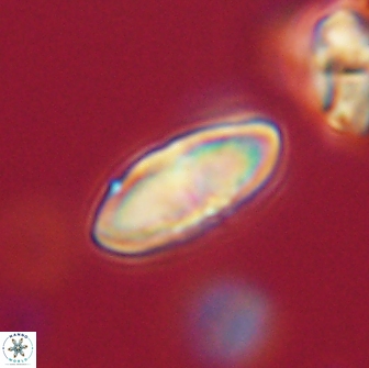 Discoaster lenticularis 65013