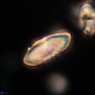 Discoaster lenticularis 65014
