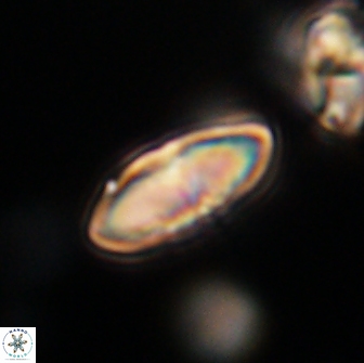 Discoaster lenticularis 65014
