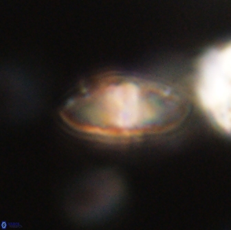 Discoaster lenticularis 65015
