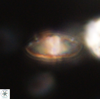 Discoaster lenticularis 65015