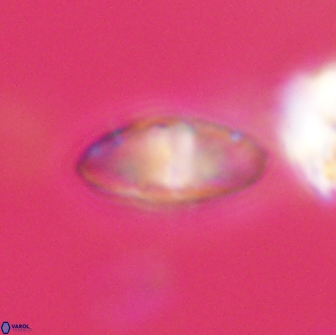 Discoaster lenticularis 65016