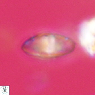 Discoaster lenticularis 65016