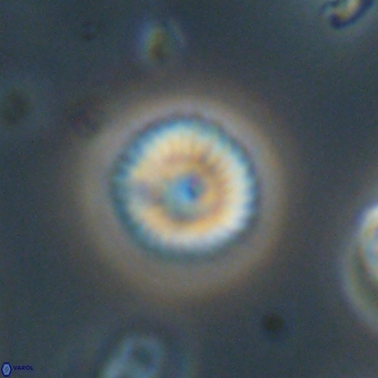 Discoaster lenticularis 67041