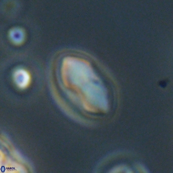 Discoaster lenticularis 67043