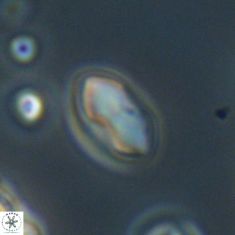 Discoaster lenticularis 67043