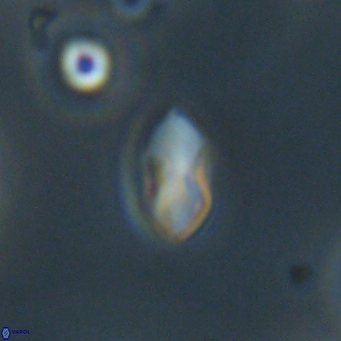 Discoaster lenticularis 67044