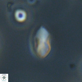 Discoaster lenticularis 67044