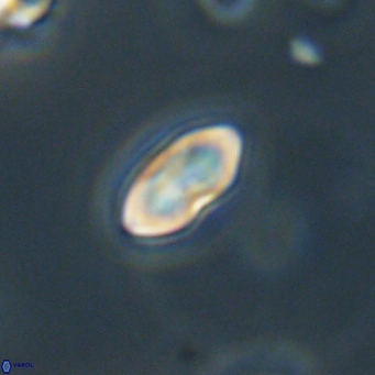 Discoaster lenticularis 67045