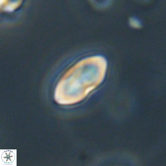 Discoaster lenticularis 67045
