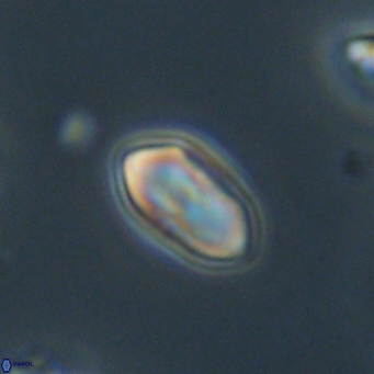 Discoaster lenticularis 67047