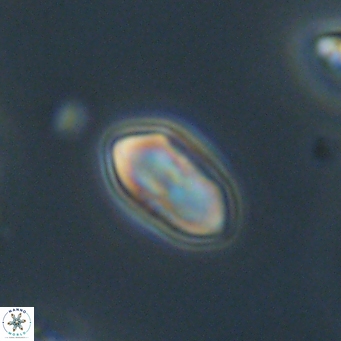 Discoaster lenticularis 67047