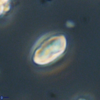 Discoaster lenticularis 67048