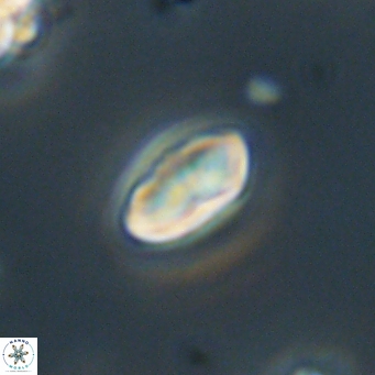 Discoaster lenticularis 67048