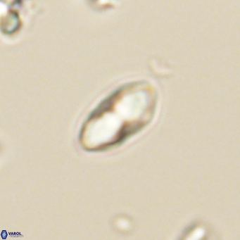 Discoaster lenticularis 67049