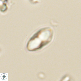 Discoaster lenticularis 67049