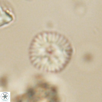 Discoaster lenticularis 67053