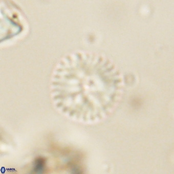 Discoaster lenticularis 67054