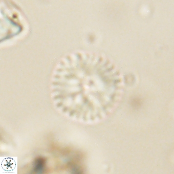 Discoaster lenticularis 67054