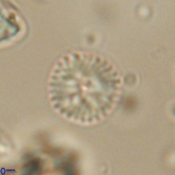 Discoaster lenticularis 67055