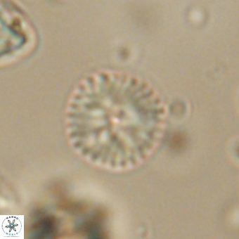 Discoaster lenticularis 67055