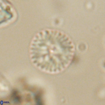 Discoaster lenticularis 67056