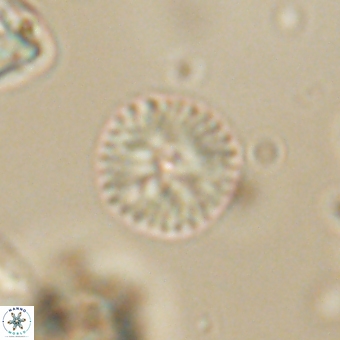 Discoaster lenticularis 67056