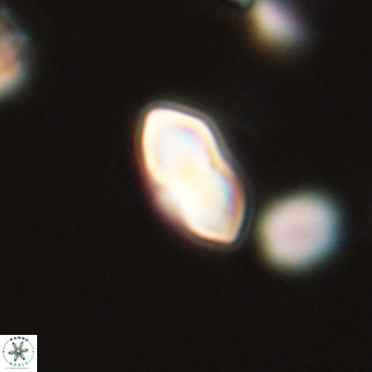 Discoaster lenticularis 67060