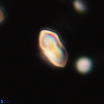 Discoaster lenticularis 67061