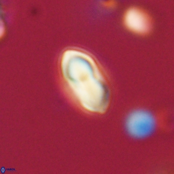 Discoaster lenticularis 67062