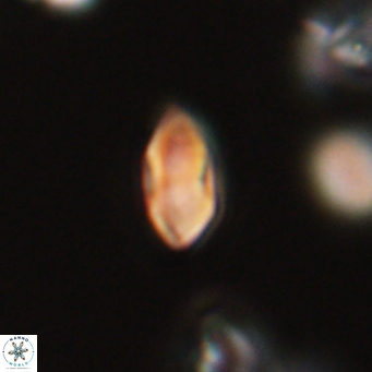 Discoaster lenticularis 67064