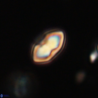 Discoaster lenticularis 67066