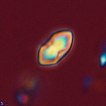 Discoaster lenticularis 67067
