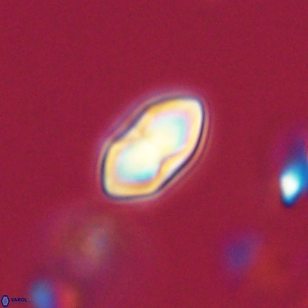 Discoaster lenticularis 67068
