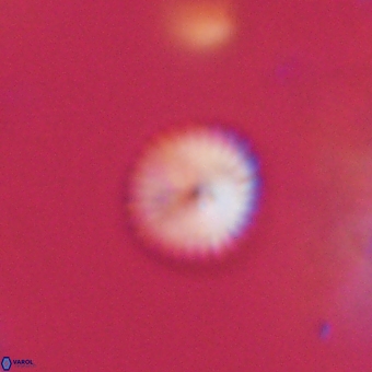 Discoaster lenticularis 67035