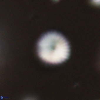 Discoaster lenticularis 67036