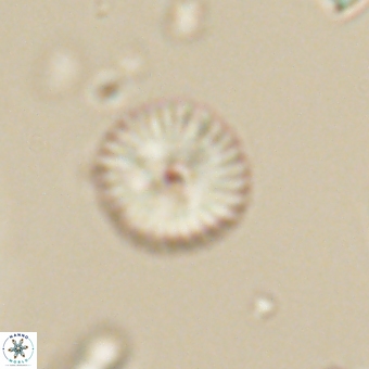 Discoaster lenticularis 67038