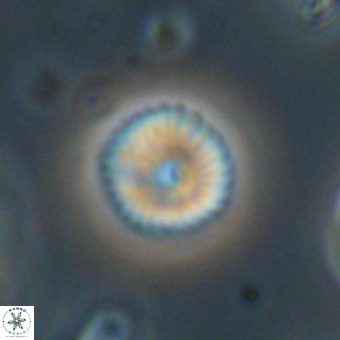 Discoaster lenticularis 67039