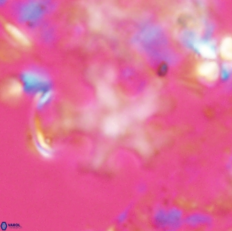 Discoaster leroyi 27736